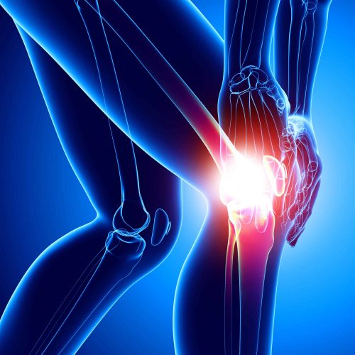 bodybuilding injuries - Knee Injury