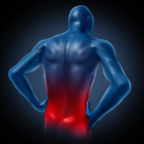 bodybuilding injuries - lower back injury